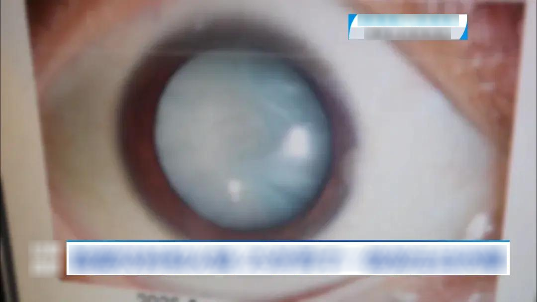 94bce56f9724c66033a9.png