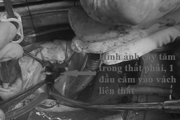 970fb426cd7c6146bb1f.jpg