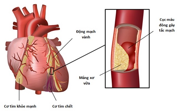 9b0ec5ab6b790283b175.jpg