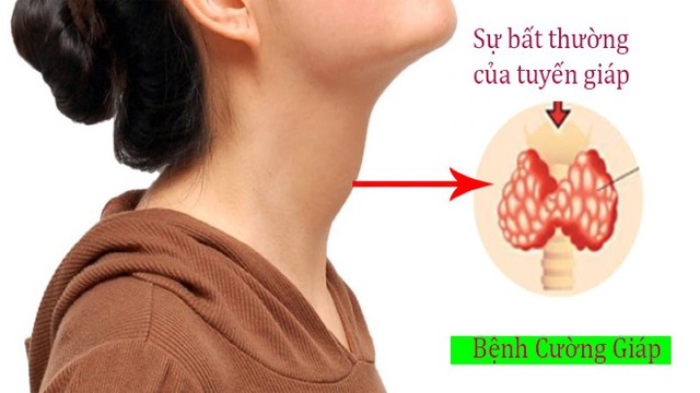 a1790154a6beb880e8de.jpg