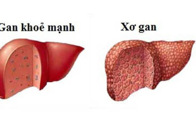 a4bacef90fce3decaaab.jpg