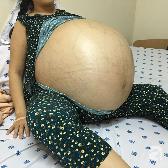 a4fda99395696a08f282.png