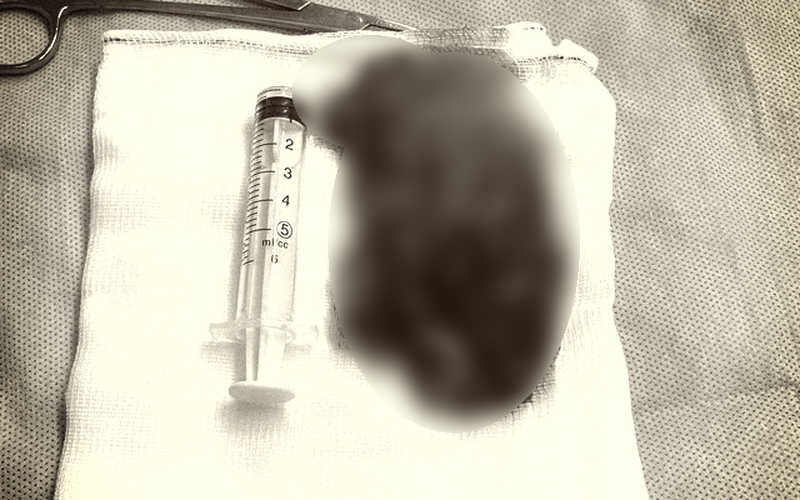 a5c2460940f494f53fe7.png
