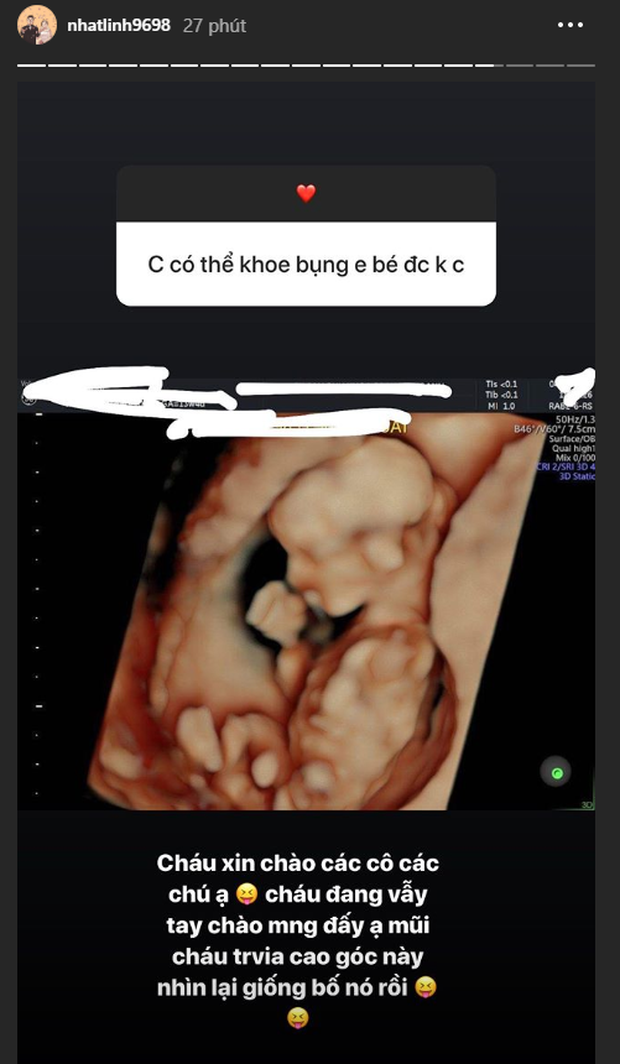 a9d2c7305659ab95dfbd.png