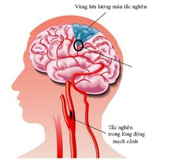 aae380f755eeeb9b89fb.jpg
