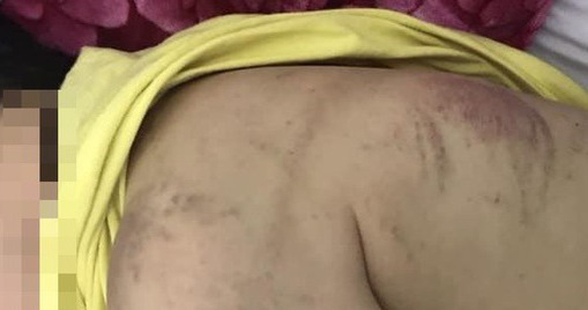 ab020d48dead95e8f0b0.jpg