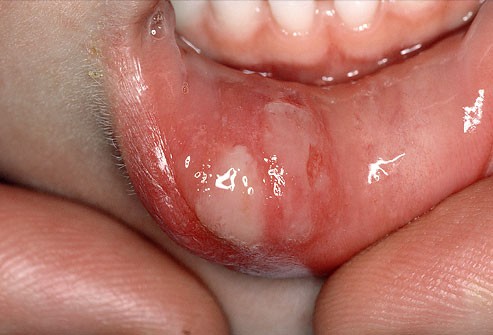 ab3f03feafe006962df8.jpg