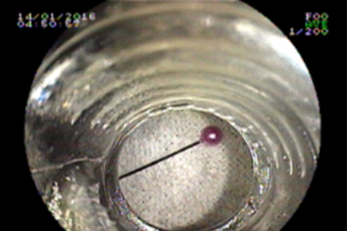 b580c16a47b757014c3a.png