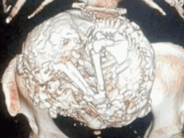 b7ba31d31c9e42f60e86.jpg