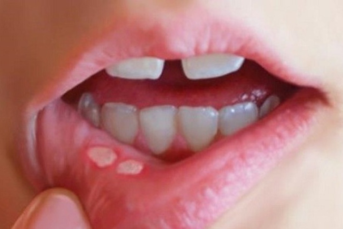 b816afe1ee780e67e475.jpg