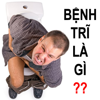 ba45d53cc12acc7fbe6c.jpg