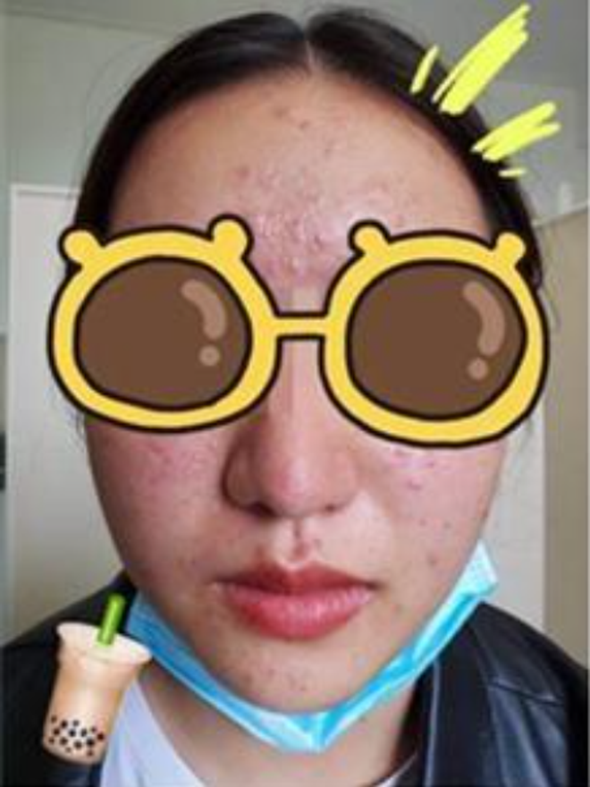 ba46af0eff48cabd97a9.png