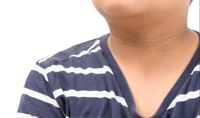 bb96ddf4bfc09a52a4cf.jpg