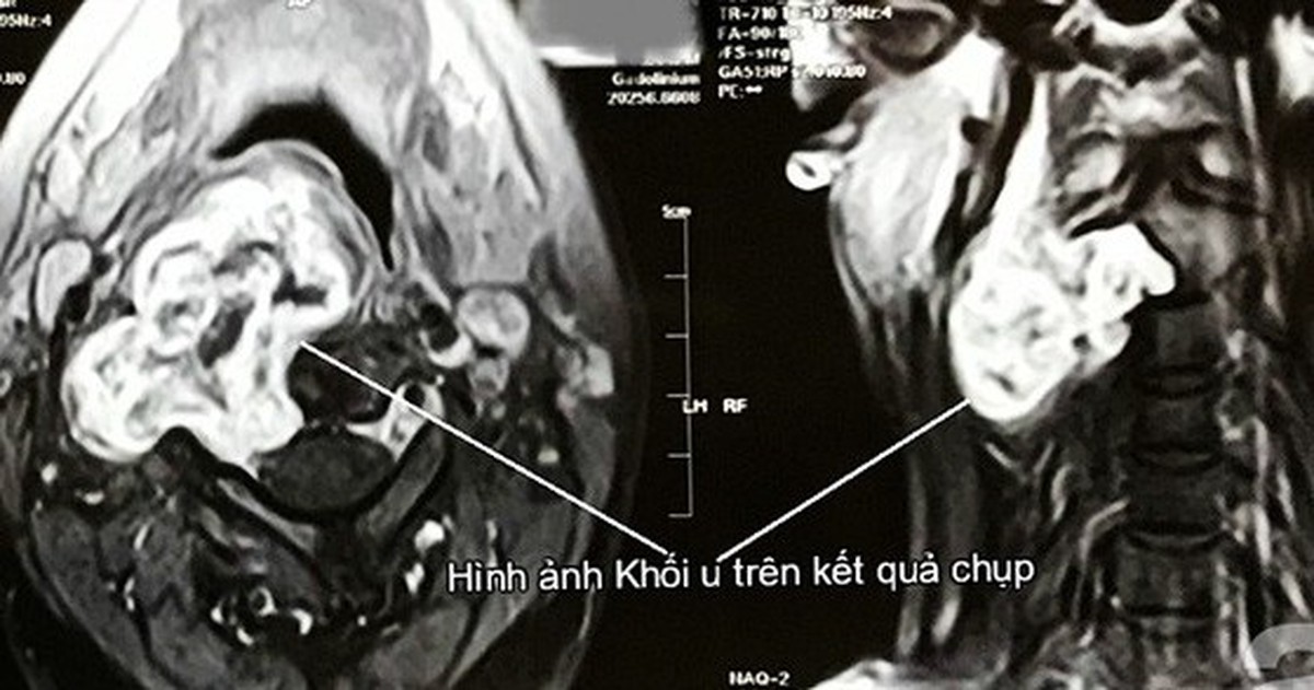 bcd3e0004cea46934c7d.jpg