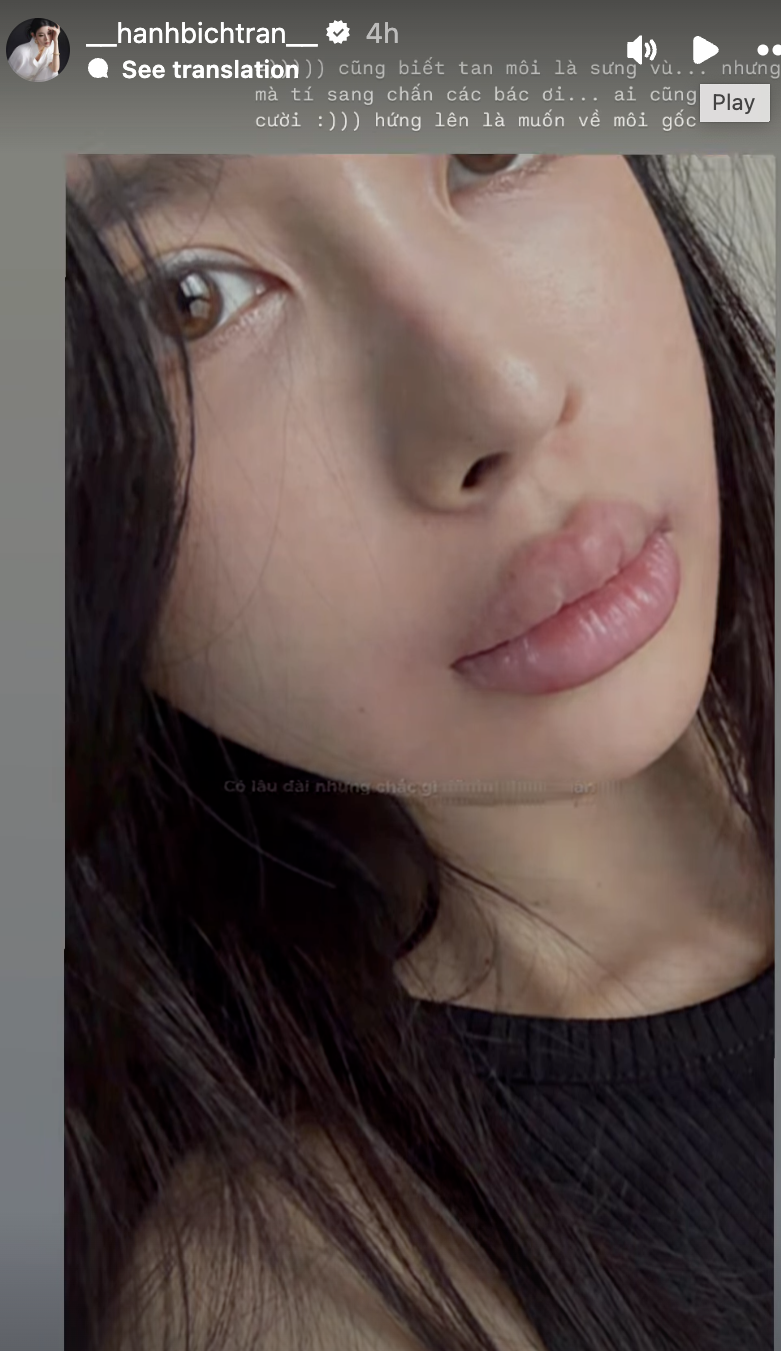 beca1d5652e4751bb421.png
