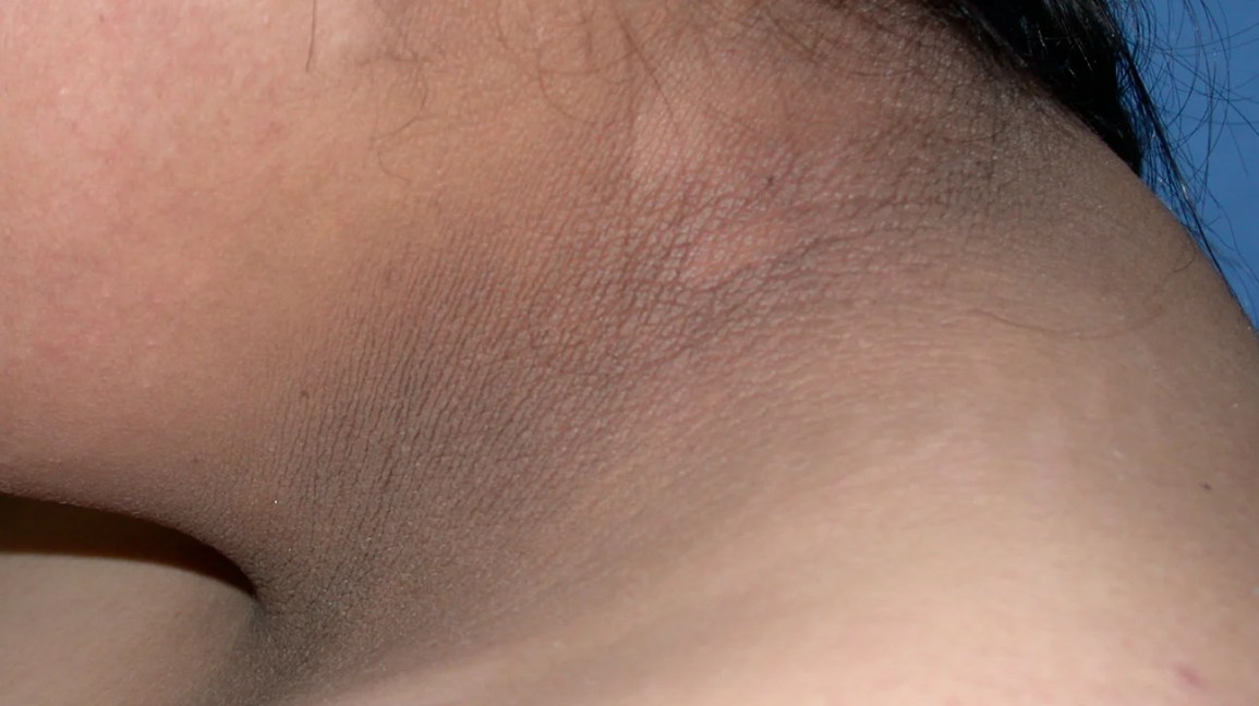 c06acb6cb7415594306e.jpg