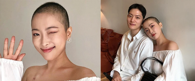 Cô gái xinh đẹp chiến đấu với ung thư 1 năm bằng nụ cười: "Mọi chuyện sẽ ổn thôi, tóc sẽ mọc lại"