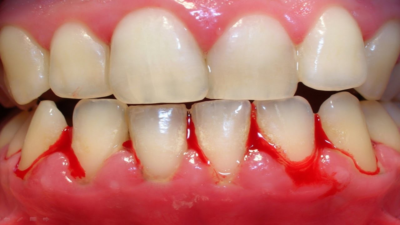 c96511176ffe741a5d83.jpg