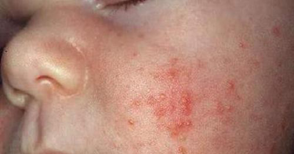 c9a9ebd1390a8db35823.jpg