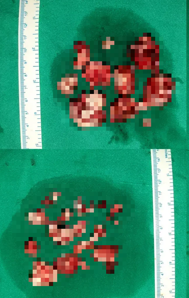 d2754ec6961256f911f9.png