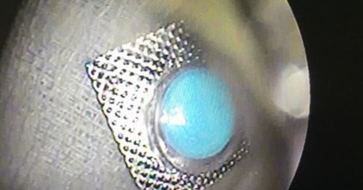 d58b89252e21c03ac263.jpg