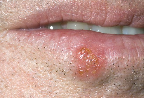 d7cb868fbd14690df642.jpg