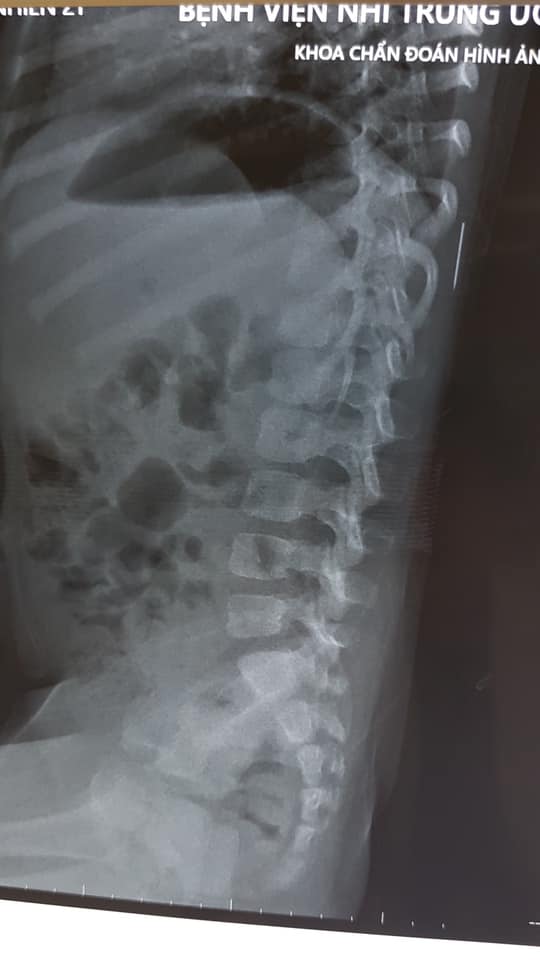 d94e1e5701449192576f.jpg