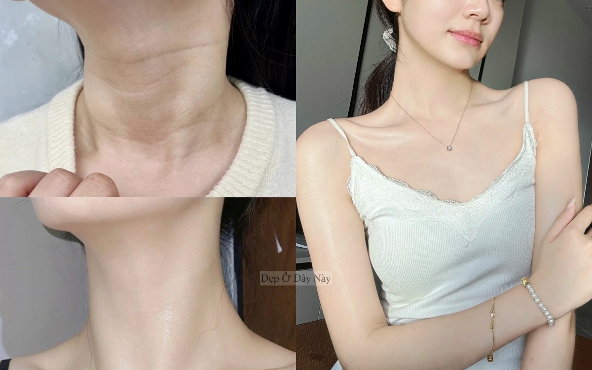 dac2afa6b63c7c12a080.jpg