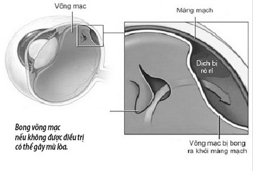 dbc32e1cdd4881f373d8.jpg