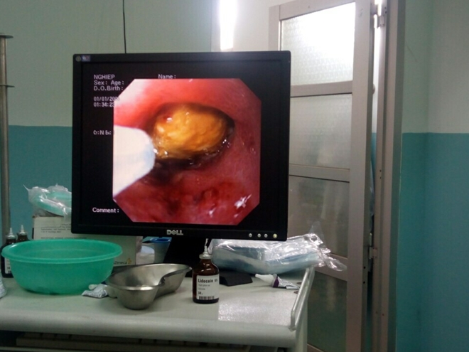 ddcd2794ac2a9b51e3bb.jpg