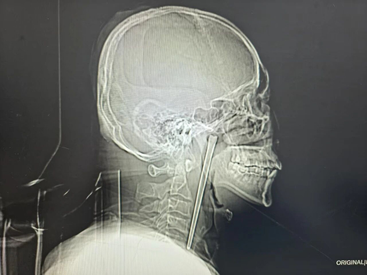 e32405cd3d3b9cc1c09b.jpg