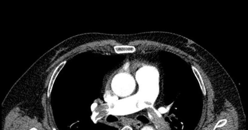 e36bbdeac3577e7426d0.jpg