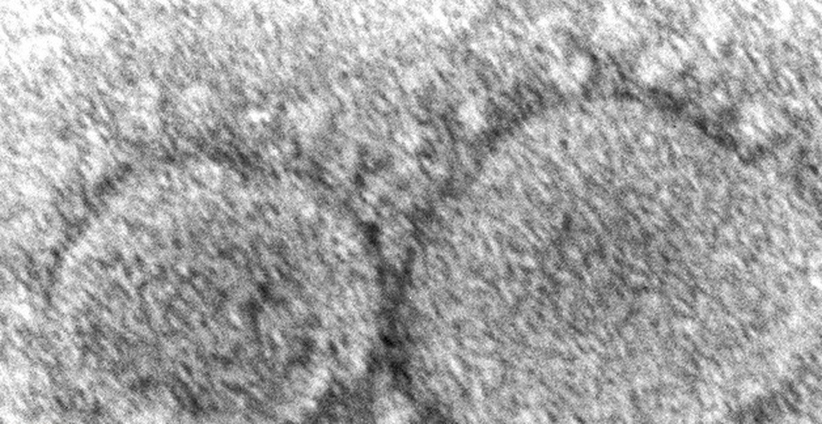 e43cd36f9782dd7329b1.jpg