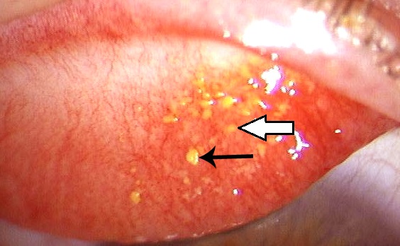 e45386cea0c844ee3261.jpg