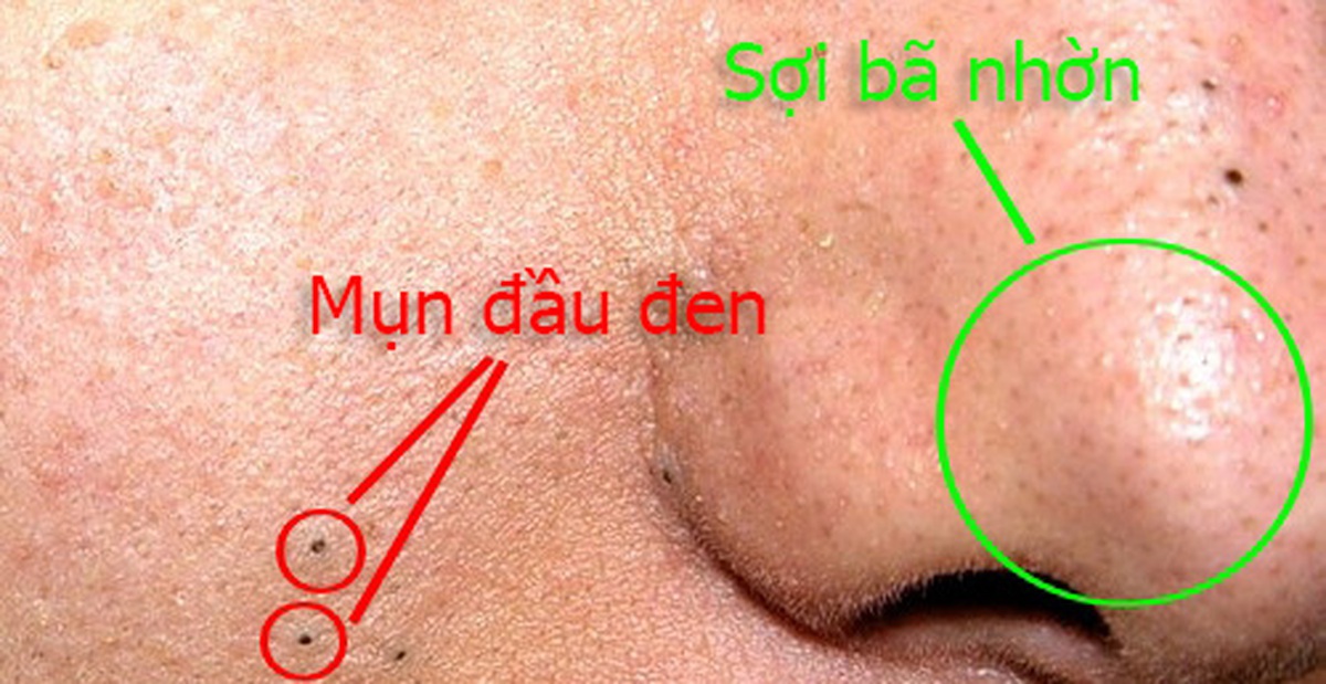 e986fb3ee4e388bc15f6.jpg