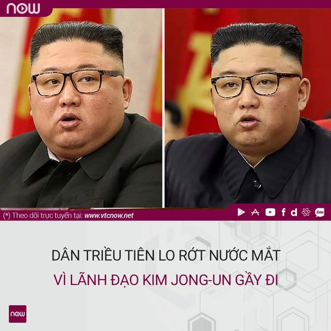 Thương quá Ủn ơi, gầy hẳn đi rồi còn gì!