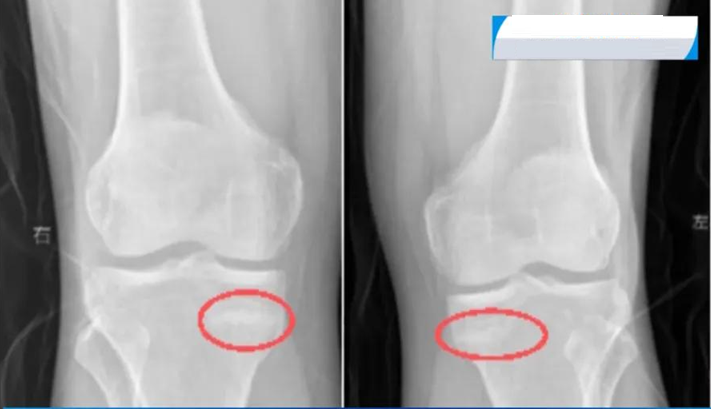 ec5e522ab71ff62cdfe9.png