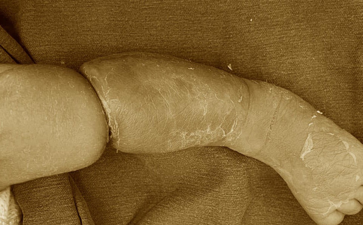 ecc5dfd39d7f2e28d5a0.jpg