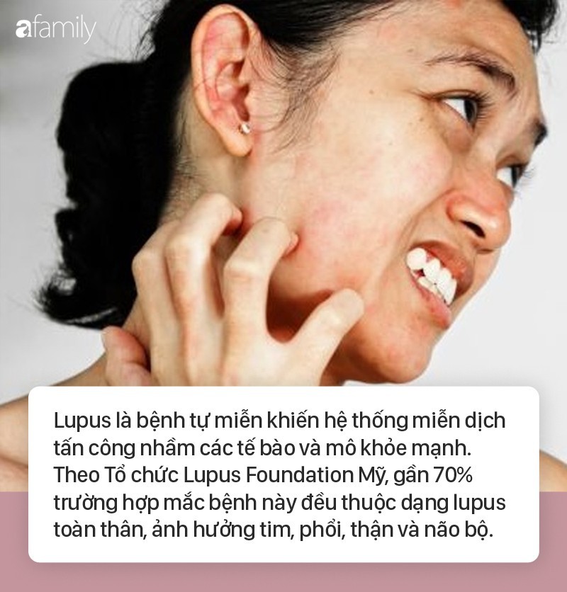 f8144363bc0c4bc492f9.jpg