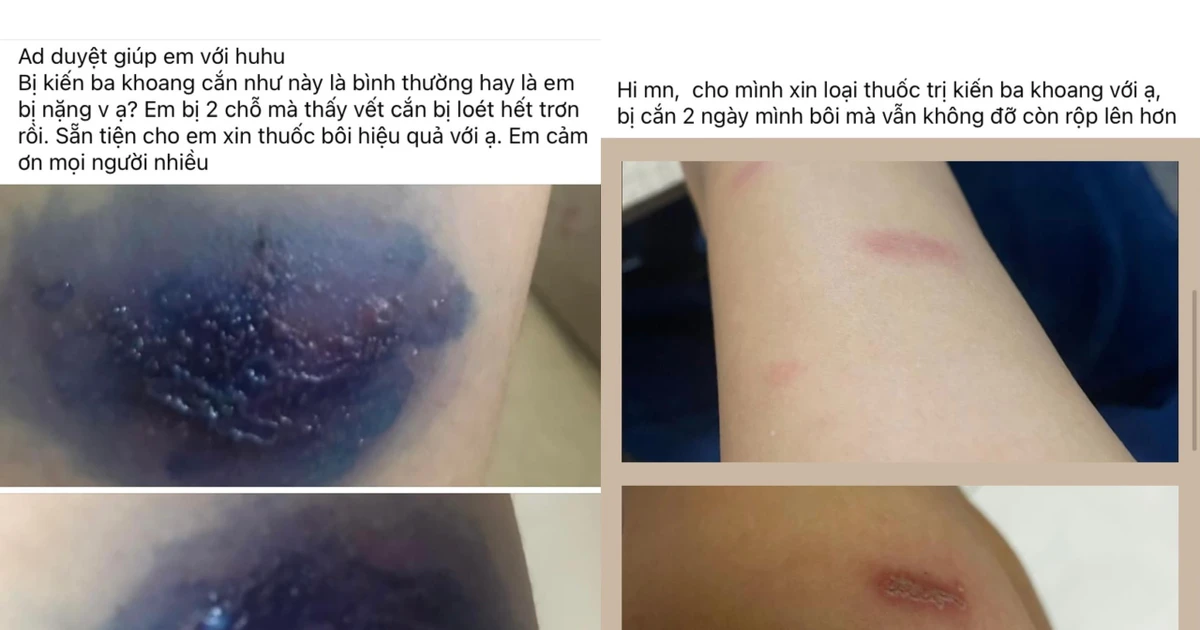 Sinh viên KTX Khu B ĐHQG TP.HCM "khóc thét" vì bị kiến ba khoang tấn công tới tấp