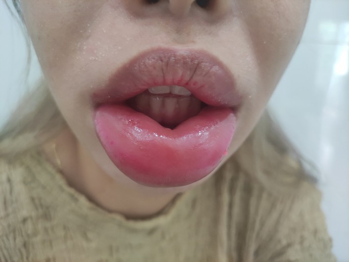 f9c761b8bd33c5f31015.jpg